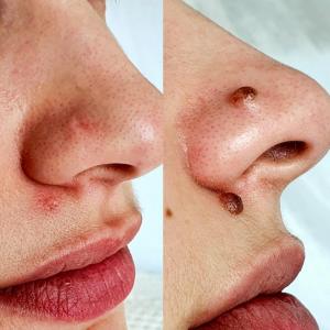 Фотография Медкрионика 4