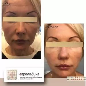 Фотография ПревентаМед 1